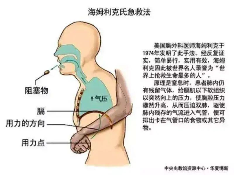 TVT体育16岁男生喝珍珠奶茶致卡喉死亡医生：如果大家会这一招就好了！(图2)